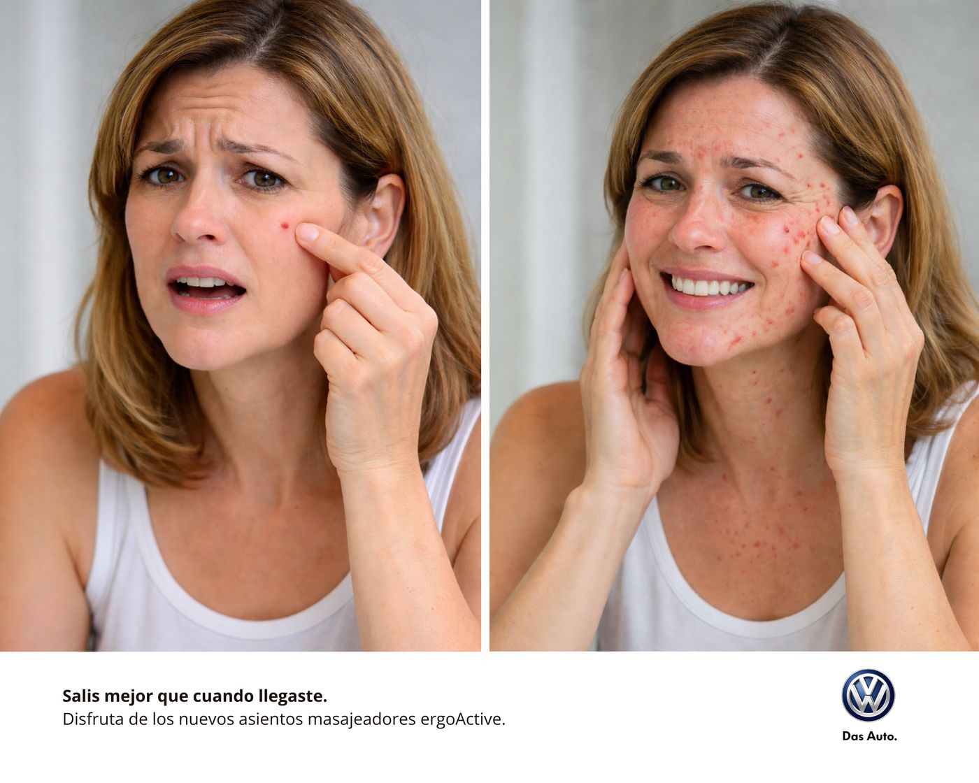 Diptych: woman with irritated skin, then clear and relaxed